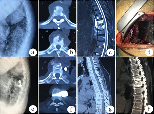Best Spine Surgeon in Kerala