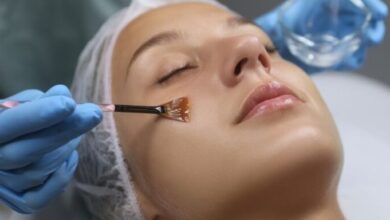 Chemical Peel in Kolkata
