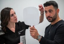 Hair Restoration Chicago