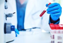 Gamca Medical for UAE