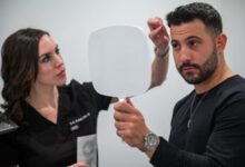 Hair Restoration Chicago