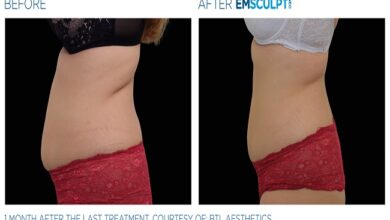 Best Treatment for Fat Loss