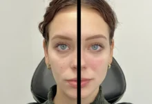 Regenerative treatments Chicago