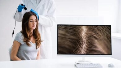 Exosome Therapy Hair Treatment