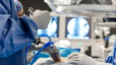 Endoscopic Spine Surgery in Kerala