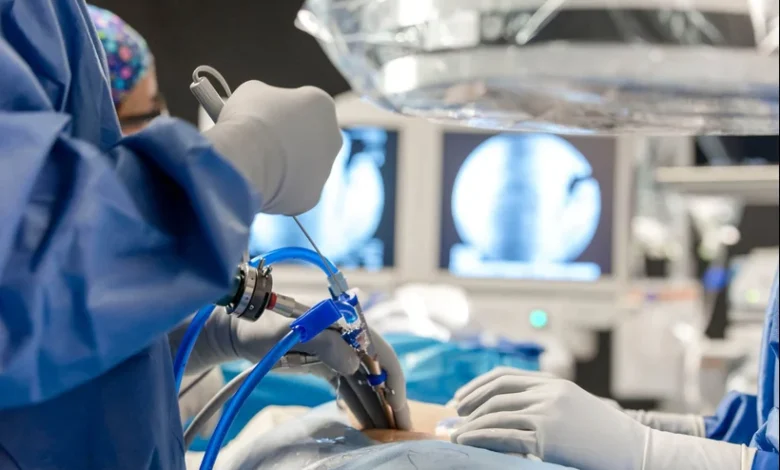 Endoscopic Spine Surgery in Kerala